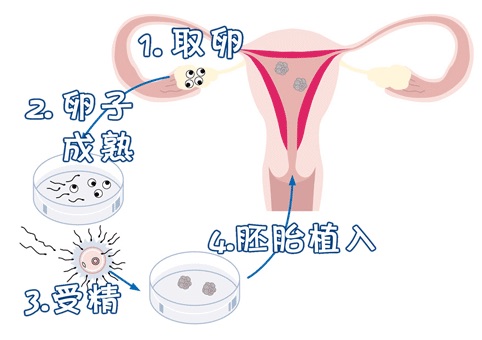 关于冰原生殖